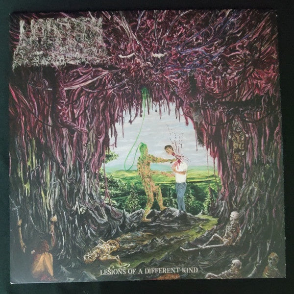 Undeath - Lesions Of A Different Kind (Ltd Ed/Slime Green Vinyl)